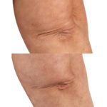 Perricone MD, Essential Fx Acyl-Glutathione Chia Hydrating Body Oil, 118ml - Image 4